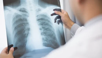Anvisa aprova novos medicamentos para o tratamento de câncer avançado