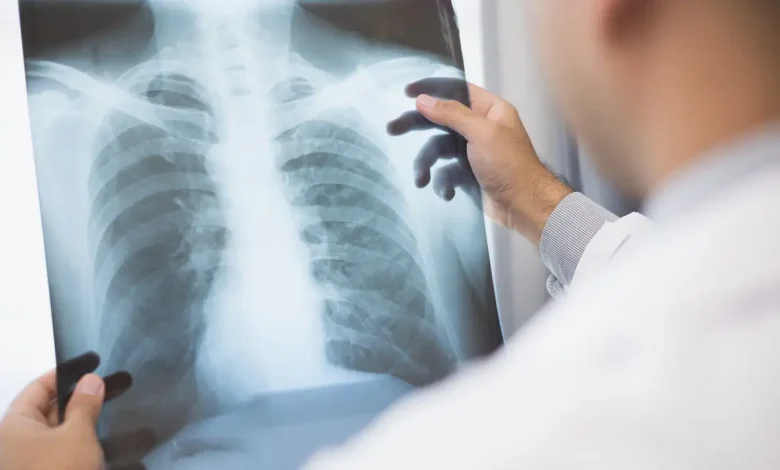 Anvisa aprova novos medicamentos para o tratamento de câncer avançado