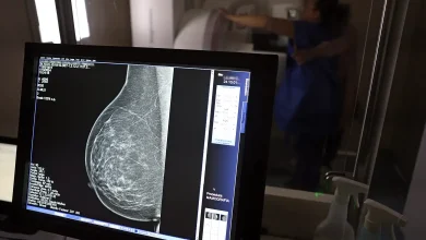 Setor médico cria manual para barrar negativa de mamografia digital em planos