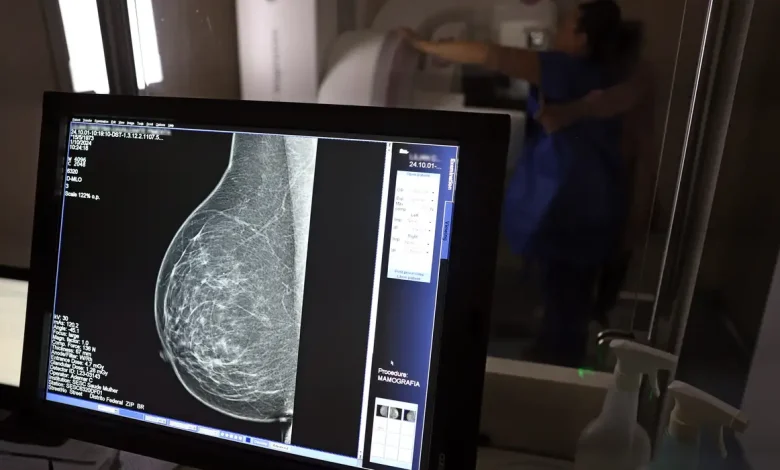 Setor médico cria manual para barrar negativa de mamografia digital em planos